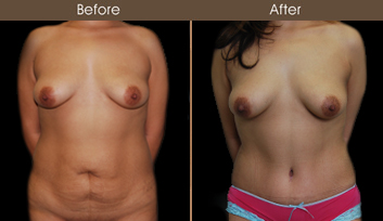 20202608152719_B21-Front-Template